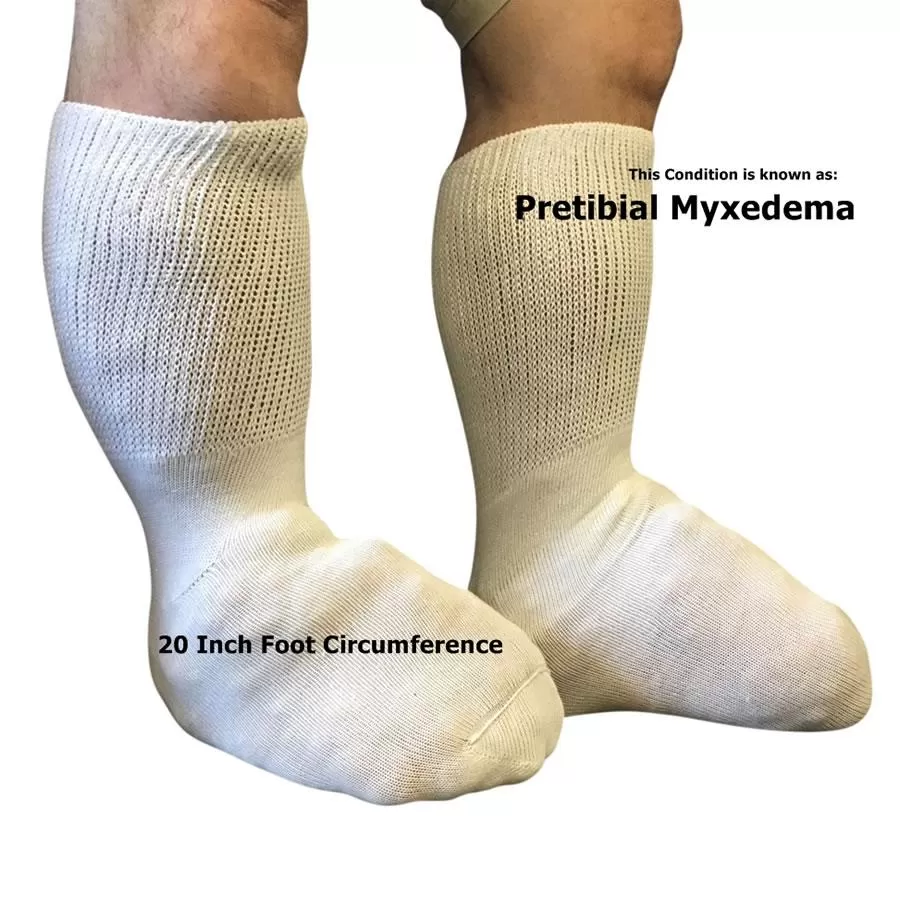 Extra Wide Bariatric Sock  (2PK)